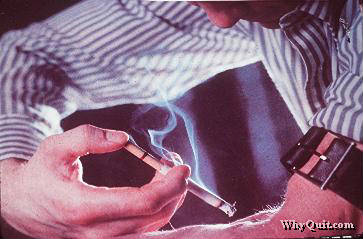 Smoker injecting a cigarette into his arm Addiction to smoking nicotine is real drug addiction
